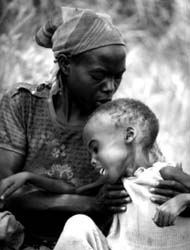 Zagodzone dziecko rwandyjskie.