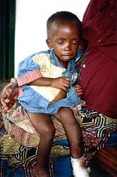 Zagodzone dziecko z Rwandy
