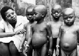 Opuchnite z godu sieroty w obozie uchodcw w Buhimba we wsch. Zairze