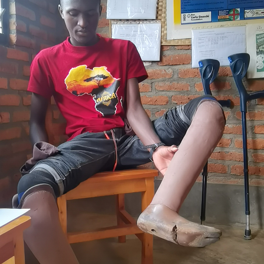 Nowe protezy nóg dla podopiecznego Adopcji Serca z Rwandy pomoc Afryce program Adopcja Serca Adopcja Duchowa Ruch Maitri 01